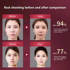 LED Photon Therapy Facial Slimming Vibration Massager Facial Lifting Device Facial Heated Double Chin V Face Vibration Massager